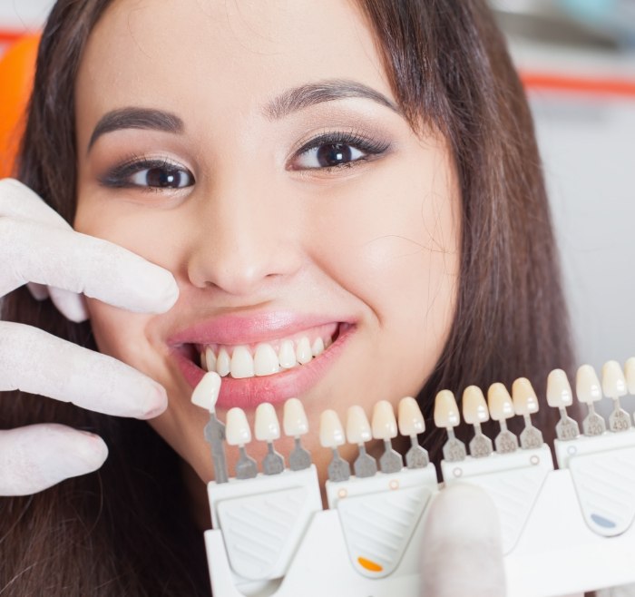 Cosmetic dentist holding a row of veneers next to a patients smile