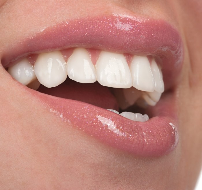 Close up of a person smiling with flawless white teeth