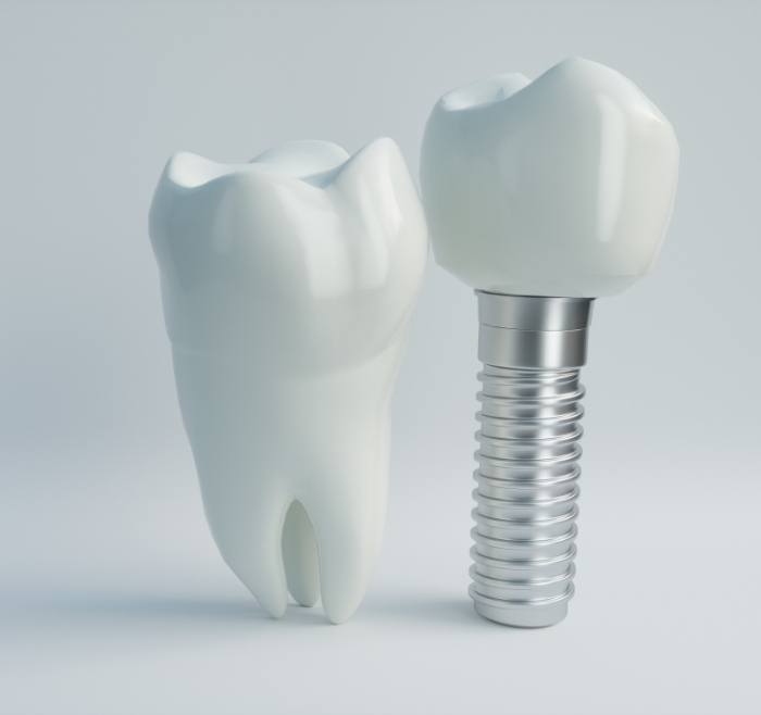 Model of a dental implant with a dental crown next to a natural tooth