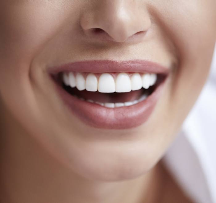 Close up of a person smiling with flawless white teeth